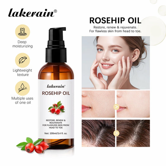 Organic Rosehip Oil Rose Hips Face Oils 30ml Fast-Absorbing Skin Care Moisturizer Face Oil Organic Rosehip Seed Oil Essence