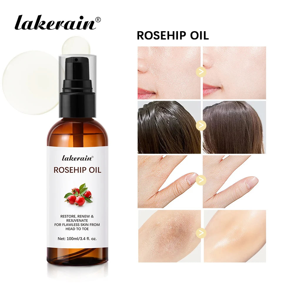 Organic Rosehip Oil Rose Hips Face Oils 30ml Fast-Absorbing Skin Care Moisturizer Face Oil Organic Rosehip Seed Oil Essence